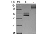 Recombinant Mouse TNFRSF17/BCMA Protein (Fc Tag)