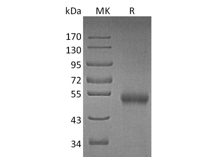 Recombinant Mouse Osteoprotegerin/TNFRSF11B Protein (His Tag)