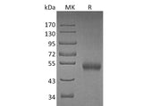 Recombinant Mouse Osteoprotegerin/TNFRSF11B Protein (His Tag)