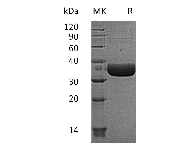 Recombinant Mouse MCPT6/Mast Cell Protease-6 Protein (His Tag)
