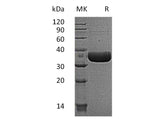 Recombinant Mouse MCPT6/Mast Cell Protease-6 Protein (His Tag)
