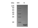 Recombinant Mouse Trefoil Factor 3/TFF3 Protein (His Tag)