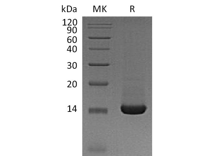 Recombinant Mouse Trefoil Factor 2/TFF2 Protein (His Tag)