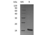 Recombinant Mouse Trefoil Factor 1/TFF1 Protein (His Tag)