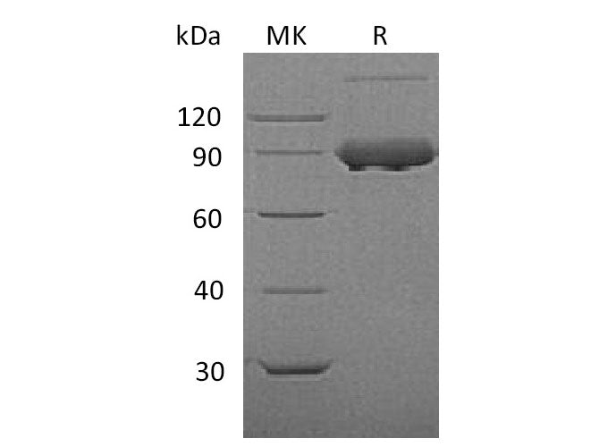 Recombinant Mouse Transferrin Receptor/TFRC Protein (His Tag)
