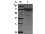 Recombinant Mouse TRAIL R2/TNFRSF10B Protein (Fc Tag)(Active)