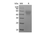 Recombinant Mouse CD86/B7-2 Protein (His Tag)