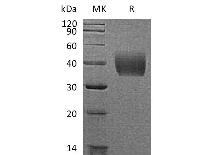 Recombinant Mouse Tissue?Factor/TF Protein (His Tag)
