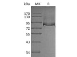 Recombinant Mouse Thrombomodulin/THBD Protein (His Tag)