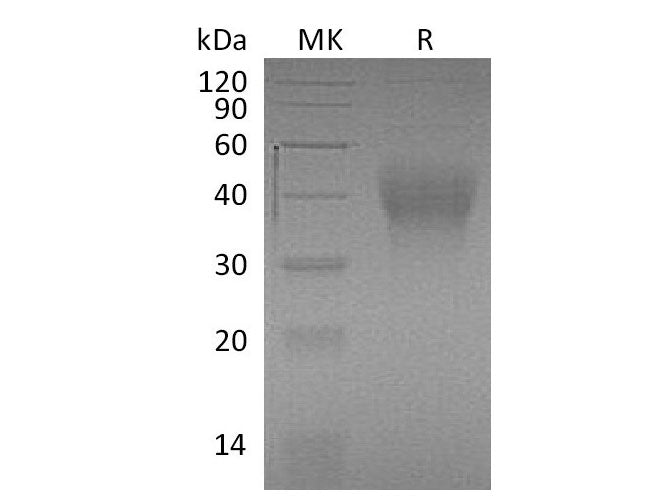 Recombinant Mouse TIM-3/HAVCR2 Protein (aa 20-191, His Tag)