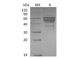 Recombinant Mouse TIM-3/HAVCR2 Protein (Fc Tag)(Active)