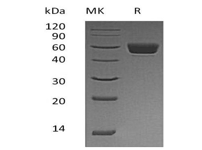 Recombinant Mouse Serpin A3N Protein (His Tag)