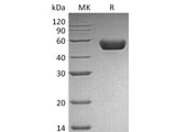 Recombinant Mouse REN1/Renin-1 Protein (His Tag)