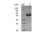 Recombinant Mouse SFTPD/SP-D Protein (His Tag) Purity >95%
