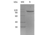 Recombinant Mouse PSGL-1/CD162 Protein (aa 42-307, Fc Tag)