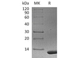 Recombinant Mouse S100A11 Protein (His Tag)(Active)