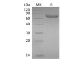 Recombinant Mouse PRLR/Prolactin Receptor Protein (Fc Tag)