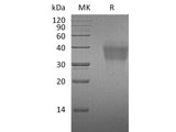 Recombinant Mouse PD-1/PDCD1 Protein (His Tag)