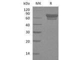 Recombinant Mouse PD-1/PDCD1 Protein (Fc Tag)(Active)