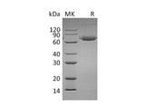 Recombinant Mouse B7-DC/PD-L2/CD273 Protein (Fc Tag)