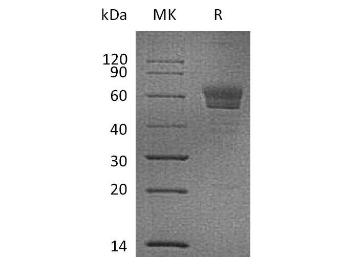 Recombinant Mouse Podoplanin/PDPN Protein (Fc Tag)