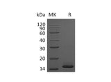 Recombinant Mouse PDGF-BB Protein (His Tag)