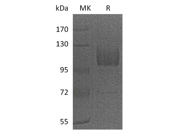 Recombinant Mouse CD36/SCARB3 Protein (Fc Tag)(Active)
