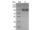 Recombinant Mouse CD31/PECAM1 Protein (His Tag)