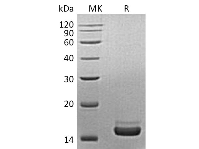 Recombinant Mouse PLA2G1B/PLA2 Protein (His Tag)