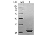 Recombinant Mouse PLA2G1B/PLA2 Protein (His Tag)