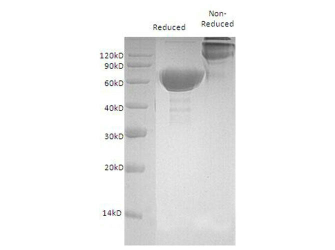 Recombinant Mouse OX40/TNFRSF4 Protein (Fc Tag)
