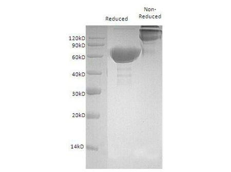 Recombinant Mouse OX40/TNFRSF4 Protein (Fc Tag)