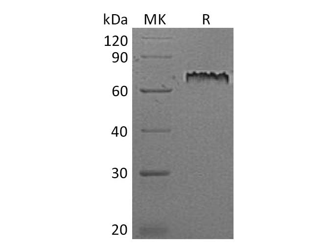 Recombinant Mouse Motch A/NOTCH1 Protein (His Tag)