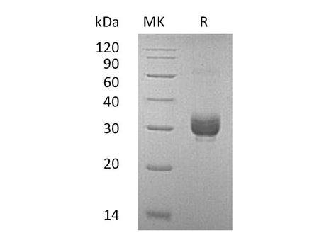 Recombinant Mouse Noggin/NOG Protein (His Tag)