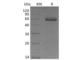 Recombinant Mouse NGAL/Lipocalin-2 Protein (Fc Tag)