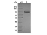 Recombinant Mouse Myeloperoxidase/MPO Protein (His Tag)