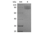 Recombinant Mouse MAG/Siglec-4a Protein (His Tag)