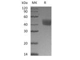 Recombinant Mouse Mesothelin/MSLN Protein (His Tag)