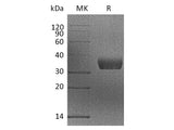 Recombinant Mouse MGL2/CD301b Protein (His Tag)