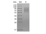 Recombinant Mouse LAMP1/CD107a Protein (His Tag)