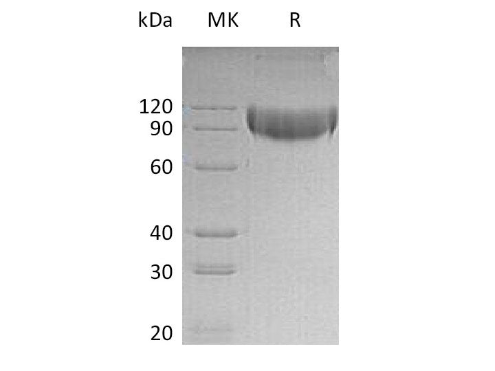 Recombinant Mouse L-Selectin/SELL Protein (His Tag) Purity >95%