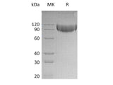 Recombinant Mouse L-Selectin/SELL Protein (His Tag) Purity >95%