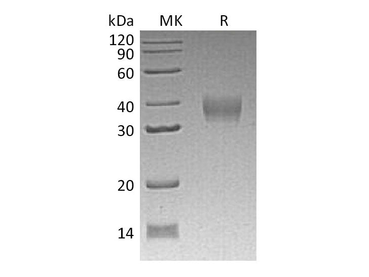 Recombinant Mouse LILRB4/CD85k/ILT3 Protein (His Tag)