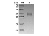 Recombinant Mouse LILRB4/CD85k/ILT3 Protein (His Tag)