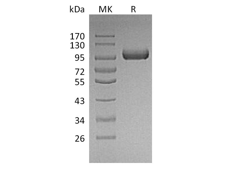 Recombinant Mouse LRIG1 Protein (His Tag)