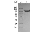 Recombinant Mouse LRIG1 Protein (His Tag)