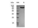 Recombinant Mouse KIRREL1/NEPH1 Protein (His Tag)