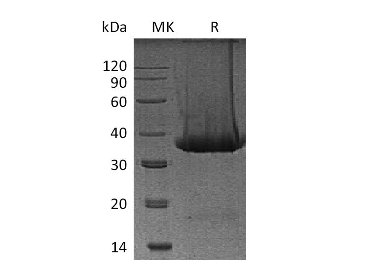 Recombinant Mouse Kallikrein 1/KLK1 Protein (His Tag)