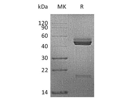 Recombinant Mouse IL-23/Interleukin-23(IL23A&IL12B) Protein (His Tag)