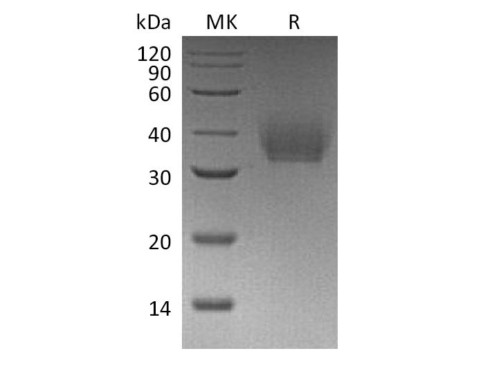 Recombinant Mouse IL-21R Protein (His Tag)